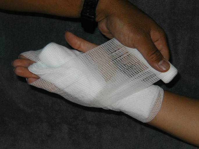 Description: Z:\Ski Patrol\refresher\Bandages\BandagePalm\PalmFigure8Bandage_files\image014.jpg