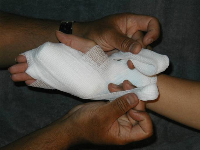 Description: Z:\Ski Patrol\refresher\Bandages\BandagePalm\PalmFigure8Bandage_files\image016.jpg