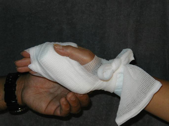 Description: Z:\Ski Patrol\refresher\Bandages\BandagePalm\PalmFigure8Bandage_files\image018.jpg